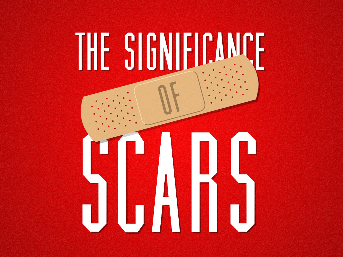 The Significance Of Scars // Pastor Ben Hackbarth